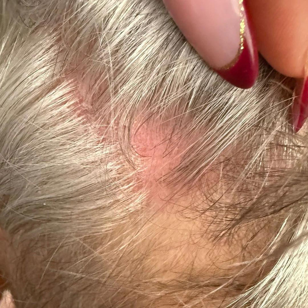 Is Your Tap Water Ruining Your Hair?