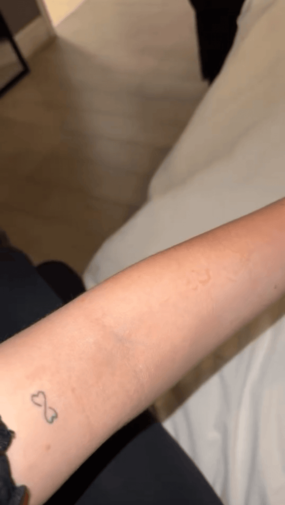 Does Chlorine in Shower Water Irritate Skin?